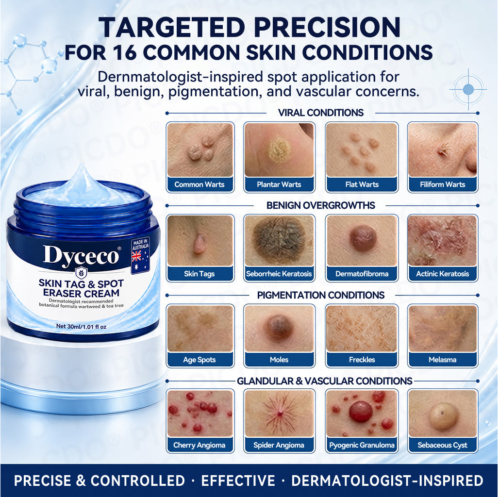 Dyceco® 🚑7-𝐃𝐚𝐲 𝐒𝐤𝐢𝐧 𝐓𝐚𝐠 & 𝐒𝐩𝐨𝐭 𝐄𝐫𝐚𝐬𝐞𝐫 𝐂𝐫𝐞𝐚𝐦 (Zero Pain, Zero 𝐒𝐜𝐚𝐫𝐬 Formula)