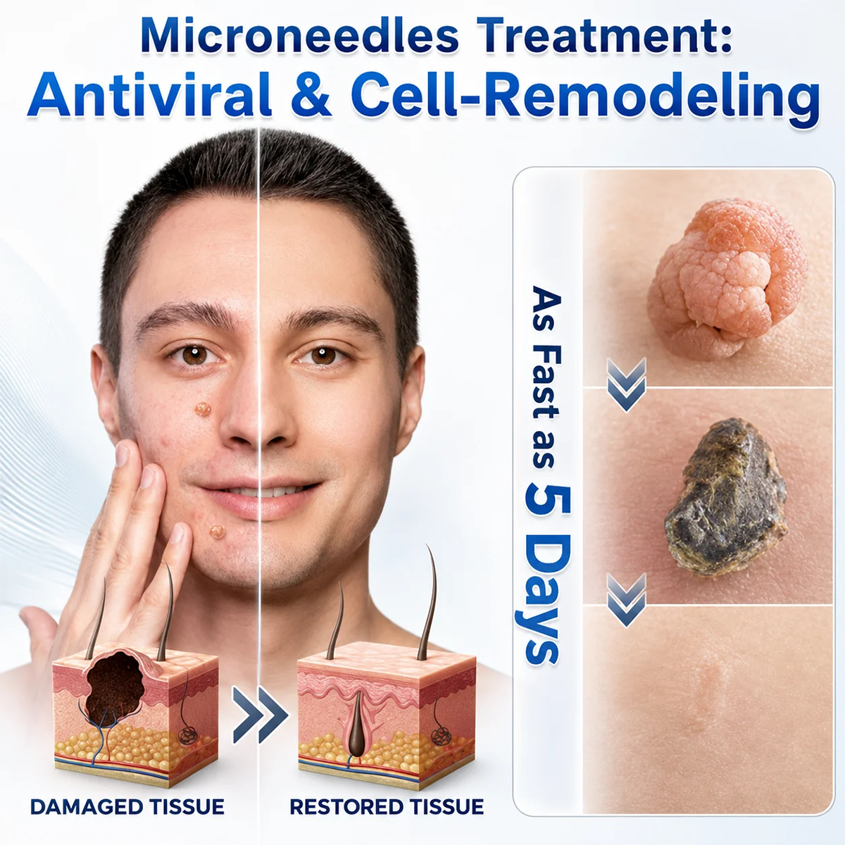 👩‍⚕️💎 𝐎𝐟𝐟𝐢𝐜𝐢𝐚𝐥 𝐒𝐭𝐨𝐫𝐞 | Dyceco® 🚑 𝐁𝐨𝐭𝐚𝐧𝐢𝐜𝐚𝐥 𝐌𝐢𝐜𝐫𝐨𝐧𝐞𝐞𝐝𝐥𝐞 𝐇𝐲𝐝𝐫𝐨𝐜𝐨𝐥𝐥𝐨𝐢𝐝 𝐏𝐚𝐭𝐜𝐡 (𝐅𝐨𝐫 𝐒𝐤𝐢𝐧 𝐓𝐚𝐠𝐬, 𝐒𝐦𝐚𝐥𝐥 𝐒𝐤𝐢𝐧 𝐆𝐫𝐨𝐰𝐭𝐡𝐬, 𝐖𝐚𝐫𝐭𝐬, 𝐌𝐨𝐥𝐞𝐬, 𝐀𝐠𝐞 𝐒𝐩𝐨𝐭𝐬 & 𝐏𝐢𝐠𝐦𝐞𝐧𝐭𝐚𝐭𝐢𝐨𝐧 𝐂𝐨𝐧𝐜𝐞𝐫𝐧𝐬)