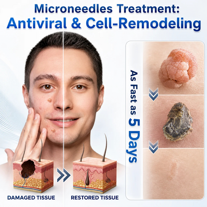 👩‍⚕️💎 𝐎𝐟𝐟𝐢𝐜𝐢𝐚𝐥 𝐒𝐭𝐨𝐫𝐞 | Dyceco® 🚑 𝐁𝐨𝐭𝐚𝐧𝐢𝐜𝐚𝐥 𝐌𝐢𝐜𝐫𝐨𝐧𝐞𝐞𝐝𝐥𝐞 𝐇𝐲𝐝𝐫𝐨𝐜𝐨𝐥𝐥𝐨𝐢𝐝 𝐏𝐚𝐭𝐜𝐡 (𝐅𝐨𝐫 𝐒𝐤𝐢𝐧 𝐓𝐚𝐠𝐬, 𝐒𝐦𝐚𝐥𝐥 𝐒𝐤𝐢𝐧 𝐆𝐫𝐨𝐰𝐭𝐡𝐬, 𝐖𝐚𝐫𝐭𝐬, 𝐌𝐨𝐥𝐞𝐬, 𝐀𝐠𝐞 𝐒𝐩𝐨𝐭𝐬 & 𝐏𝐢𝐠𝐦𝐞𝐧𝐭𝐚𝐭𝐢𝐨𝐧 𝐂𝐨𝐧𝐜𝐞𝐫𝐧𝐬)